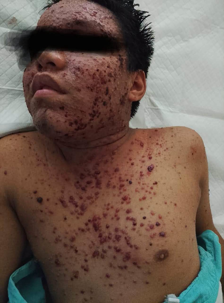 Familia denuncia negligencia médica en muerte de adolescente en IMSS